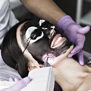 Black Carbon Picosure Laser Facial Treatment Procedure