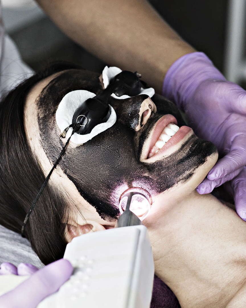 Black Carbon Picosure Laser Facial Treatment Procedure