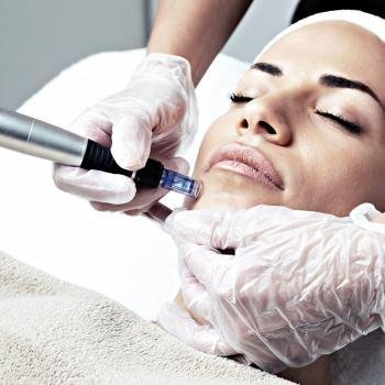 Microneedling-Facial-Microneedling-Benefits-Microneedling-Before-and-After-Microneedling-How-much-is-microneedling