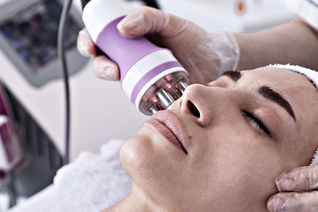 Radio-Frequency-Skin-Tightening-Facial-RF-Facial-Radio-Frequency-Skin-Tightening-Facial-RF-Skin-Treatment-Cindarella-Facial