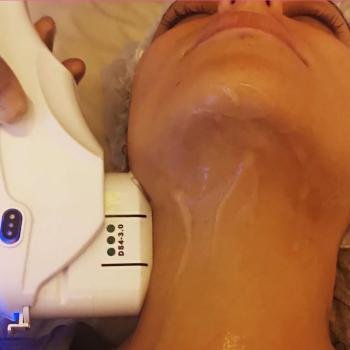 Hifu-Skin-Tightening-Facial-Ultrasound-Skin-Tightening-Facial-Ultrasound-Skin-Treatment-Non-Surgical-Face-Lift-Neck-Lift